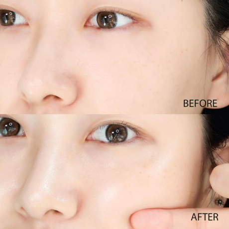 Kem dưỡng tràm trà giúp giảm mụn, kiềm dầu - Ngôi sao