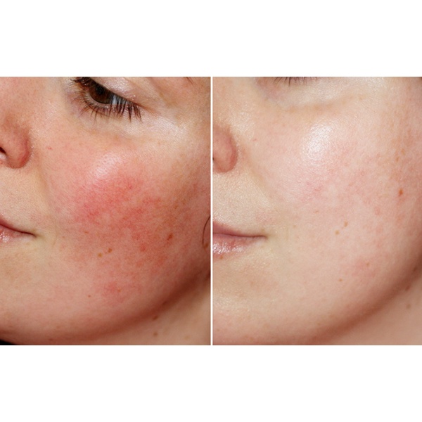 33419351da7255e5e4a9a0a27a4b5148