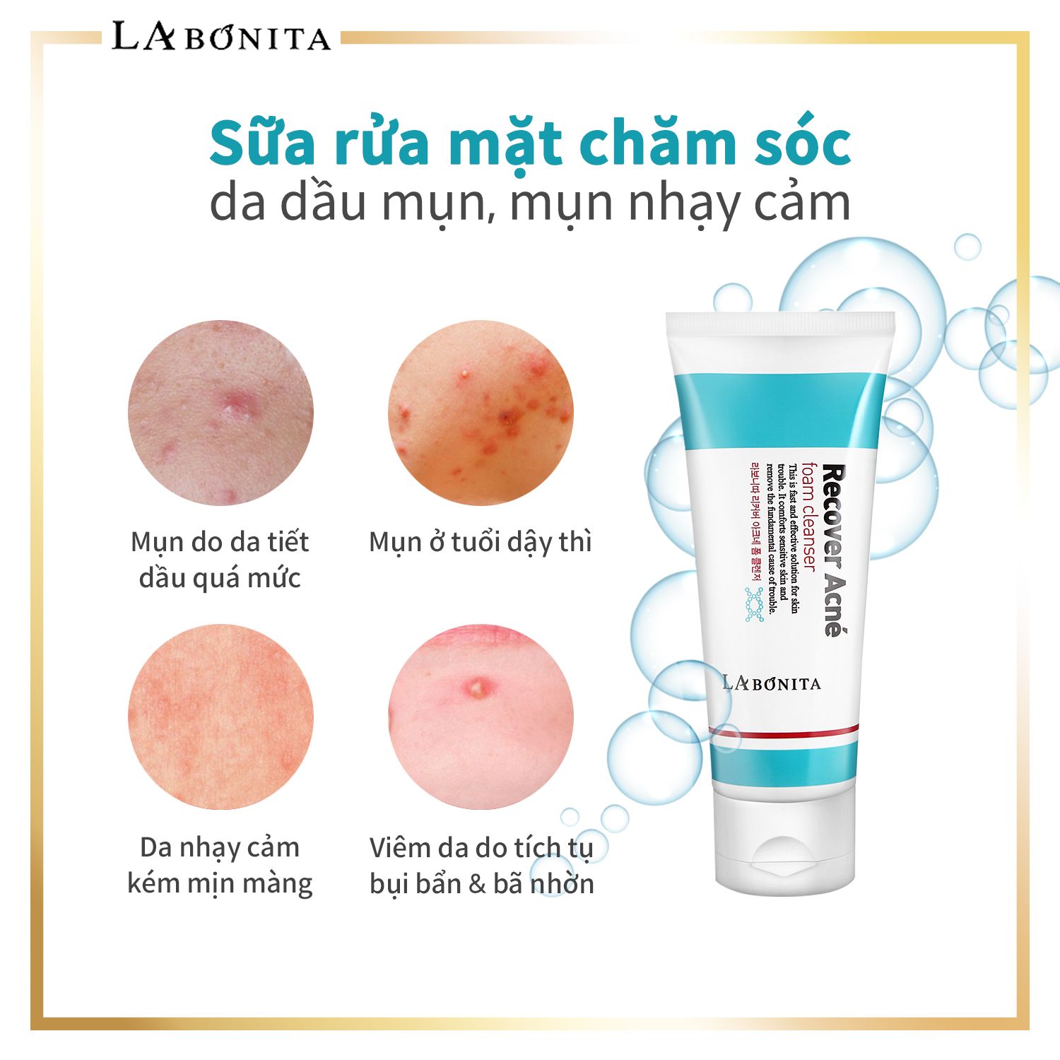 ac-srm-4_f11f47ba89d64a9e9a818a184c486263_master Sữa Rửa Mặt Cho Da Dầu Mụn La Bonita Recover Acne Foam Cleanser 100ml