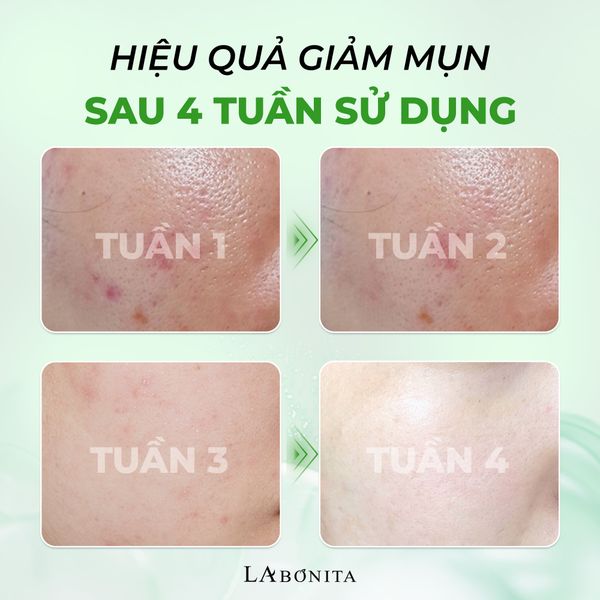 ampoule-mun-h3_d628e5c7375a405c8cfa6872d4237955_grande