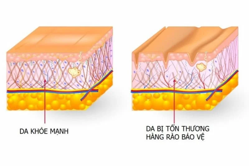 cach phuc hoi hang rao bao ve da 2