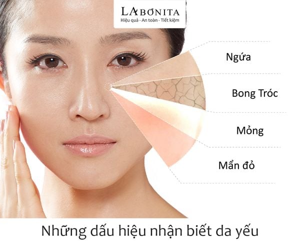 cap-am-phuc-hoi-hang-rao-bao-ve-da__2__e40a5dce58b54cf4ad038d8f54402b1c_grande-1 6 thói quen cấp ẩm phục hồi hàng rào bảo vệ da không thể bỏ qua – La Bonita Chính Hãng