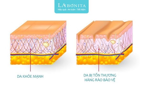 duong-am-phuc-hoi-la-gi-4_6901041bd2344c1fa20efa422fcace45_grande-1