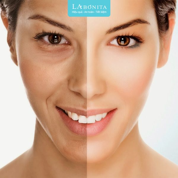 duong-am-phuc-hoi-la-gi-6_1c731ed21c9648d092d8670de808b2e6_grande