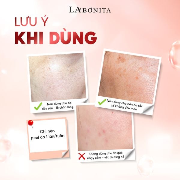 peel-da-aha-4_0a28364e616f41bbb6958d258b707f60_grande