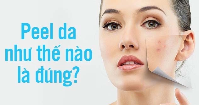 quy-trinh-peel-da-tri-mun-tai-nha