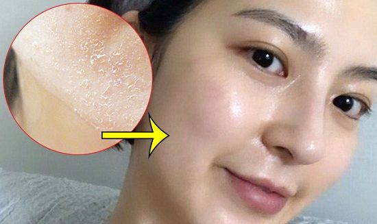 tai-sao-peeling-khong-bong-troc-da-va-chia-se-cach-phuc-hoi-cuc-don-gian-950324 Tại sao Peeling không bong tróc da và chia sẻ cách phục hồi cực đơn giản