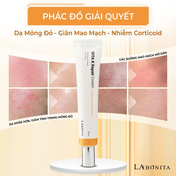 vita-k-h4__2__238218164e434a9fbeedf7e414a65cfa_grande