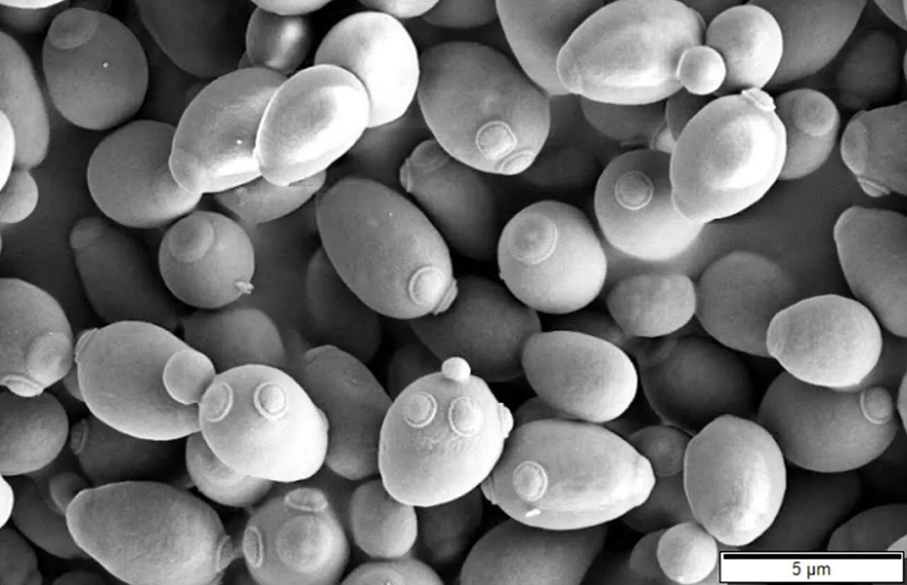 1280px-saccharomyces_cerevisiae_sem Cấu trúc phân tử siêu nhỏ giúp mỹ phẩm lên men thẩm thấu sâu hơn vào cấu trúc da