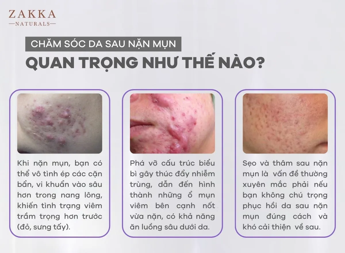 Vi khuẩn dễ dàng xâm nhập qua vết thương hở nếu không được sát trùng kịp thời