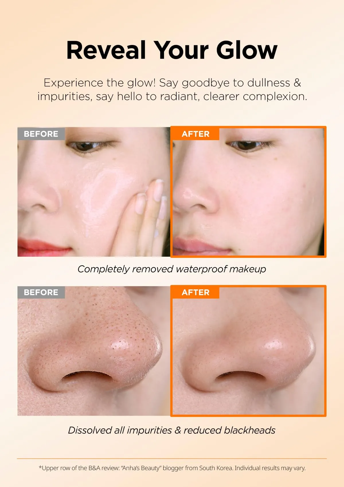 Sáp tẩy trang là giải pháp tối ưu để loại bỏ mụn đầu đen và bã nhờn hiệu quả