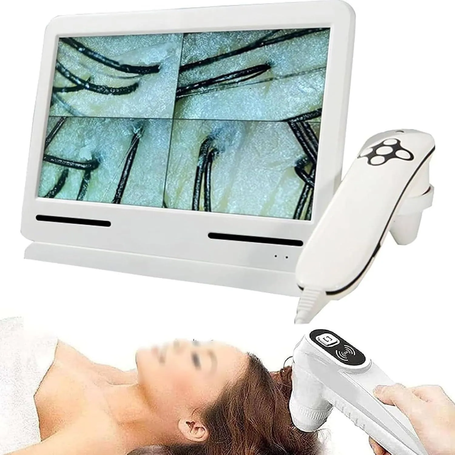 Soi da đầu giúp xác định chính xác các vấn đề cần ưu tiên trong công thức cá nhân hóa
