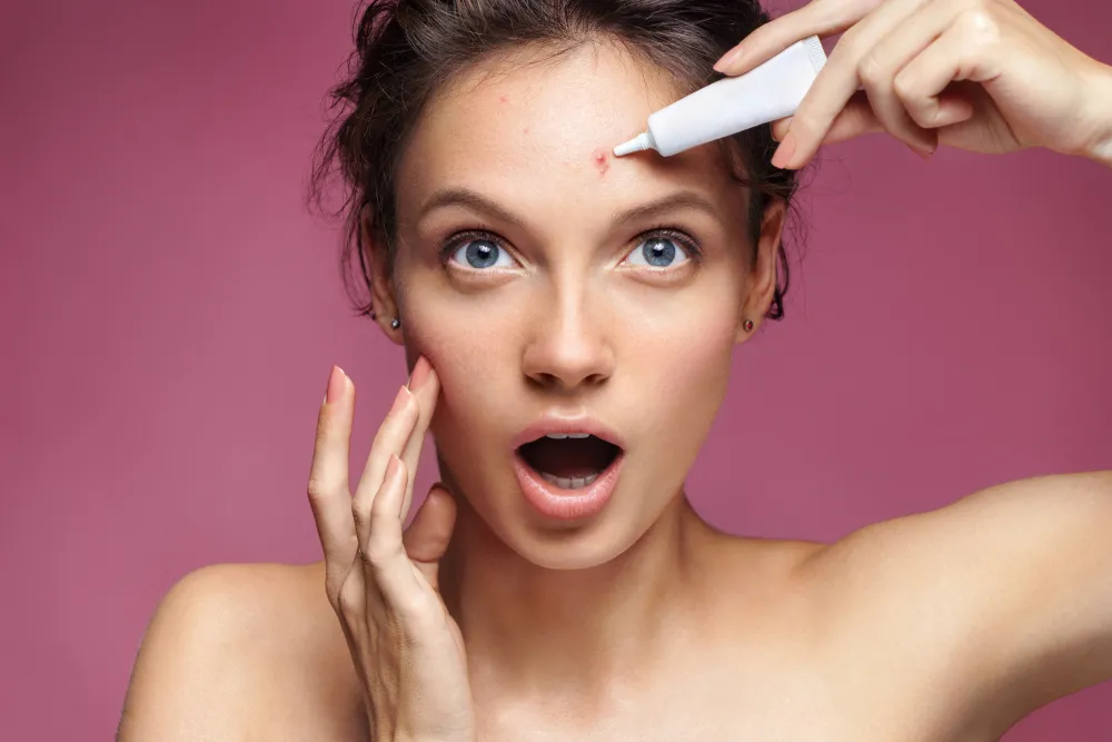 acne-spot-treatment Kỹ thuật chấm đúng điểm giúp tập trung sức mạnh tiêu diệt mụn tại ổ viêm