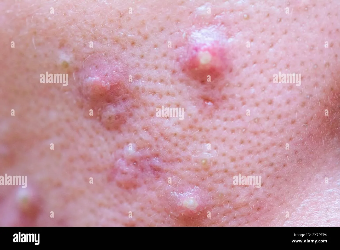 Cấu trúc phân tử Sericin giúp tăng cường khả năng thẩm thấu và giữ ẩm sâu cho tế bào da