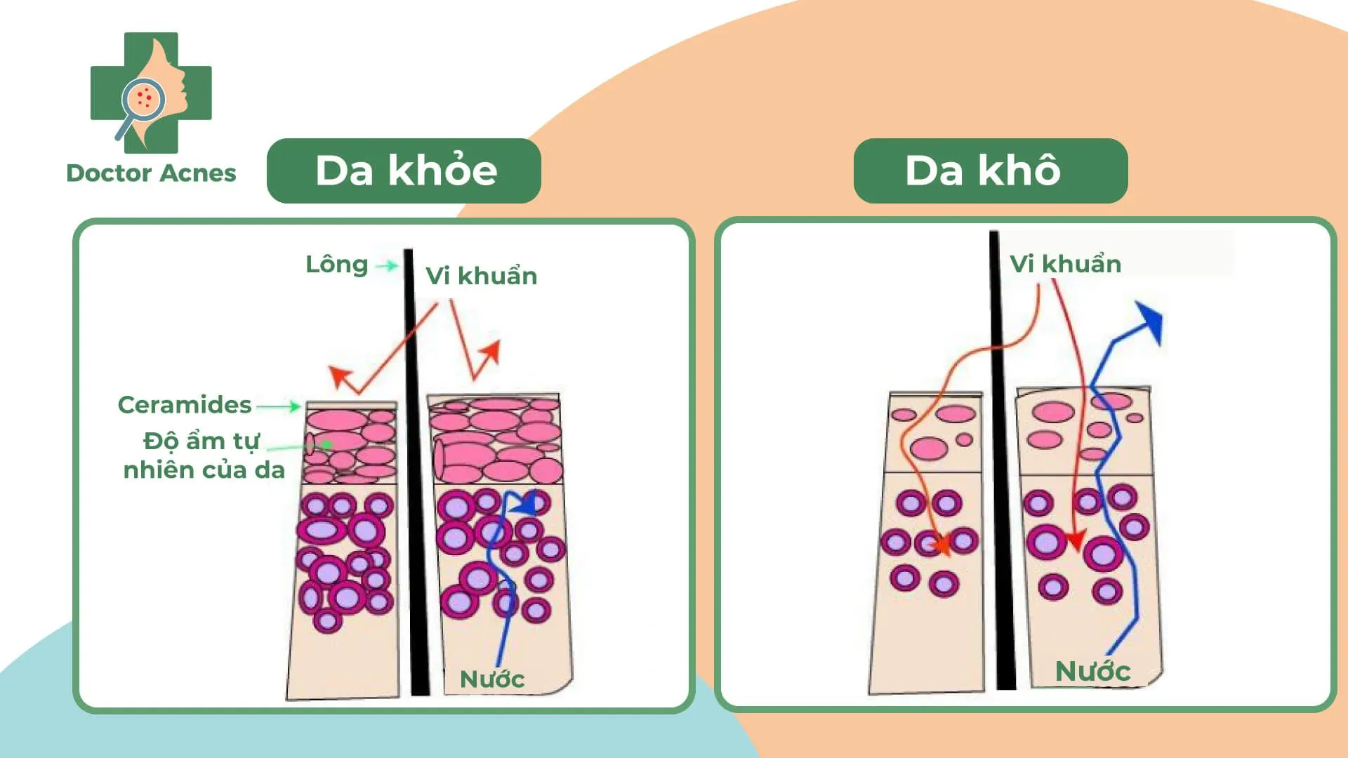 Ceramide đóng vai trò là chất kết dính quan trọng giúp da ngăn ngừa mất nước