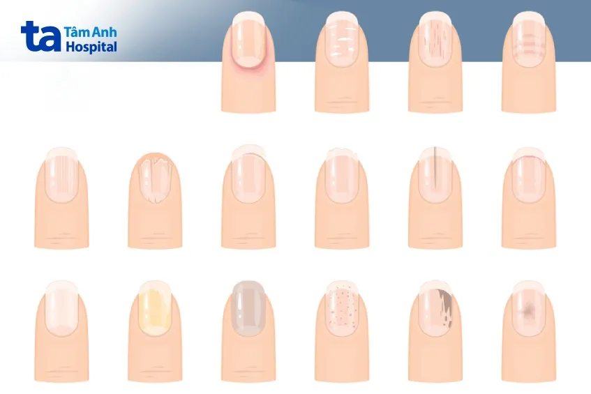 Biotin đóng vai trò then chốt trong việc duy trì cấu trúc móng vững chắc