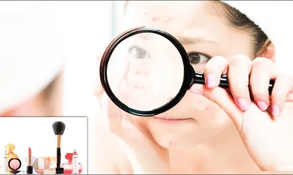 di_ung_my_pham1 Luôn là người tiêu dùng thông thái bằng cách kiểm tra kỹ lưỡng thành phần và chứng nhận y tế của sản phẩm