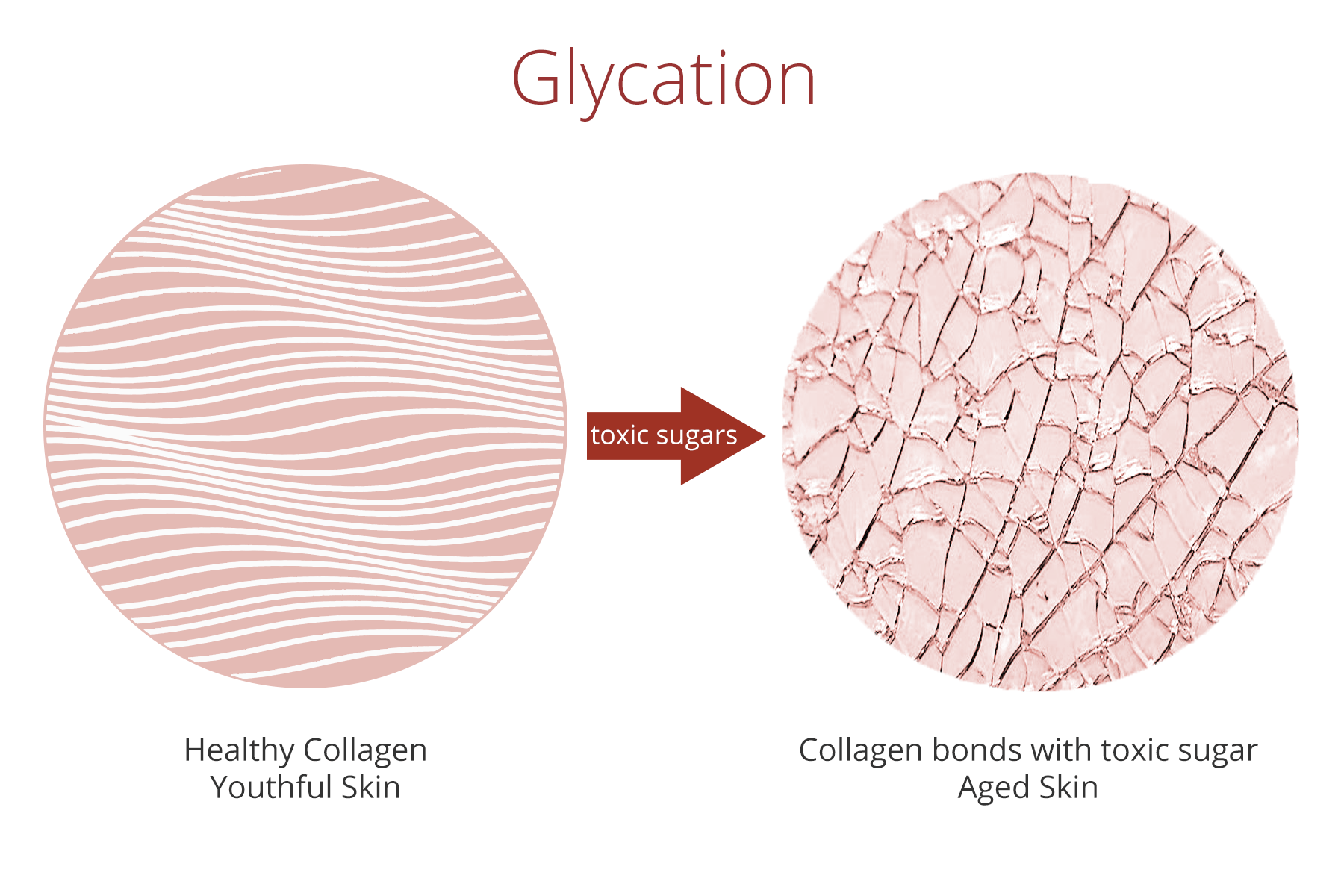 Hiện tượng Glycation là nguyên nhân hàng đầu khiến làn da mất đi độ đàn hồi và xuất hiện dấu hiệu lão hóa sớm