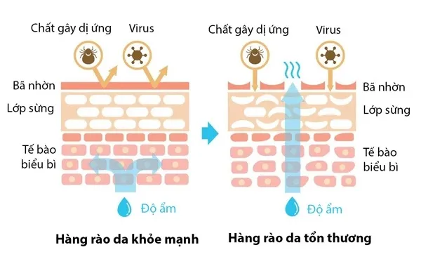 hang_rao_bao_ve_da-1 Cơ chế phá hủy hàng rào lipid bảo vệ da dưới tác động của hormone stress