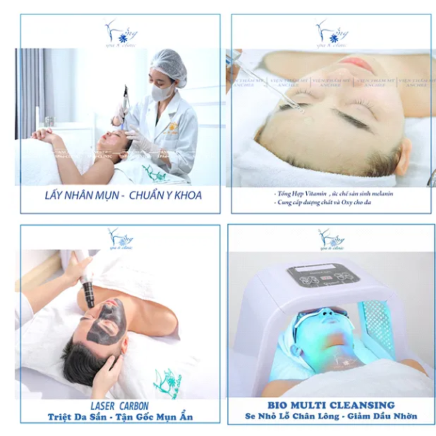 Lấy nhân mụn đúng cách giúp loại bỏ bít tắc lỗ chân lông hiệu quả và hỗ trợ quá trình điều trị