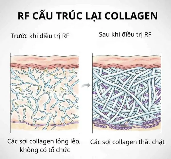 Massage đúng cách kích thích sản sinh Collagen giúp ngăn ngừa nếp nhăn hiệu quả