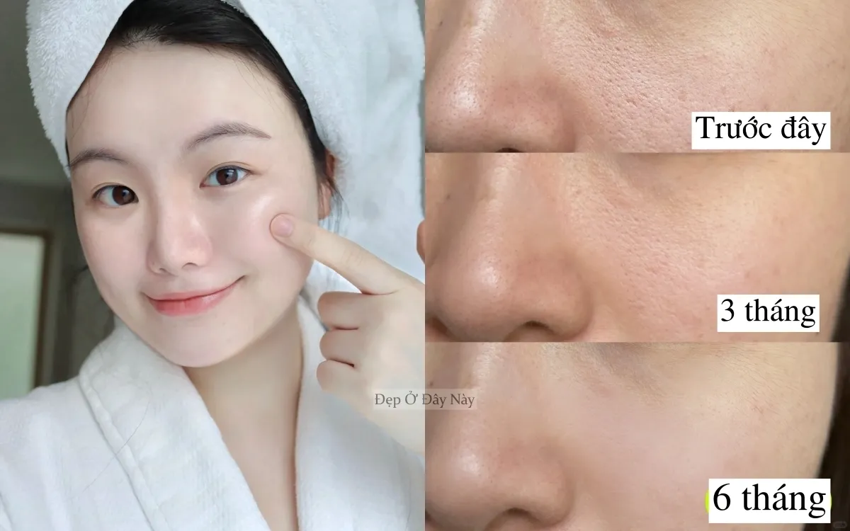 ocollage-17605892934331964213824 Cơ chế làm sạch thông minh giúp bề mặt da trở nên mịn màng và đều màu