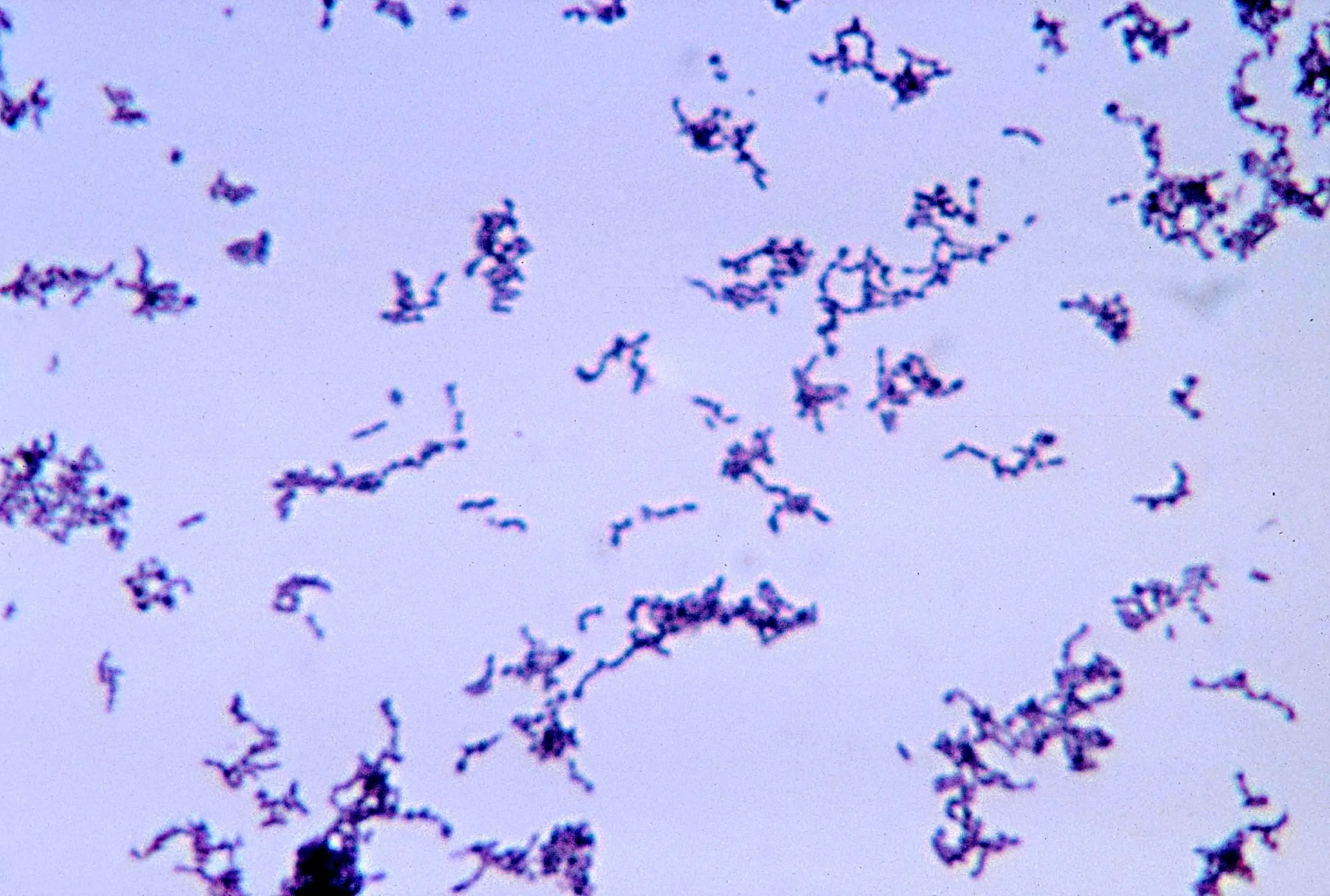 Vi khuẩn Cutibacterium acnes là tác nhân chính gây ra tình trạng viêm nhiễm trong mụn trứng cá
