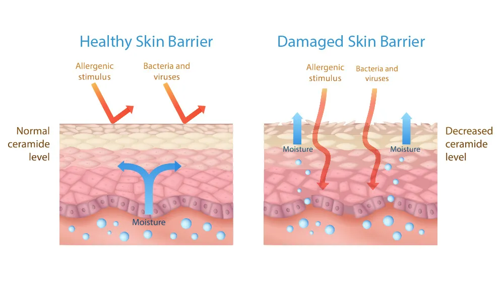 Lợi khuẩn giúp củng cố hàng rào bảo vệ da ngăn chặn vi khuẩn xâm nhập