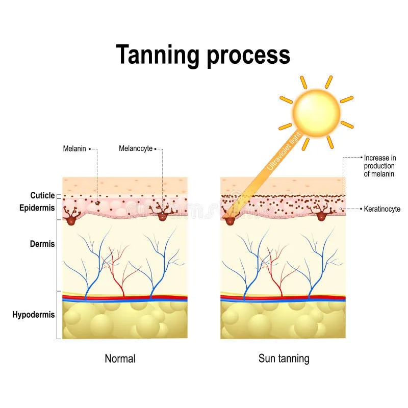 Quá trình da trở nên sậm màu do tác động của ánh nắng mặt trời kích thích sản sinh melanin