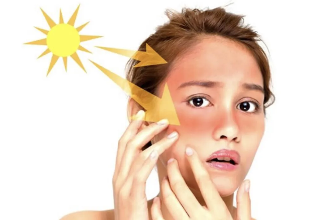 Ánh nắng mặt trời và ô nhiễm là những tác nhân hàng đầu phá hủy mạng lưới Elastin dưới da