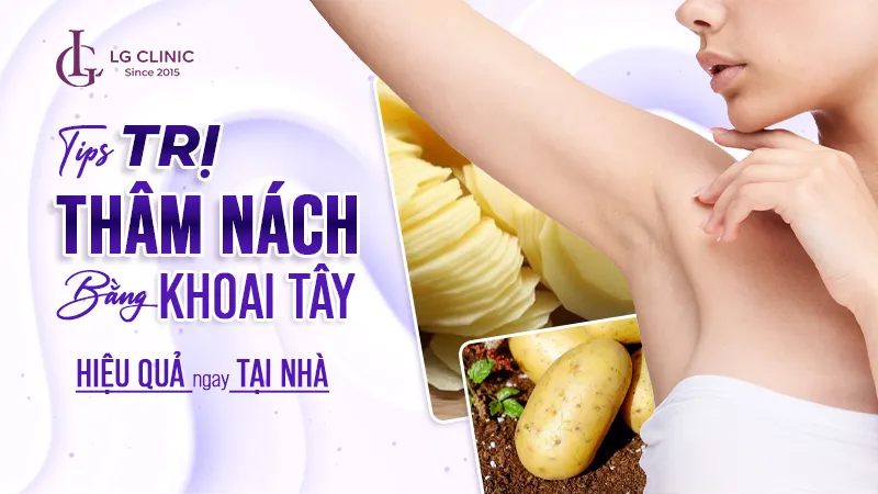 tri-tham-nach-bang-khoai-tay Các nguyên liệu tự nhiên giàu dưỡng chất giúp cải thiện sắc tố da an toàn