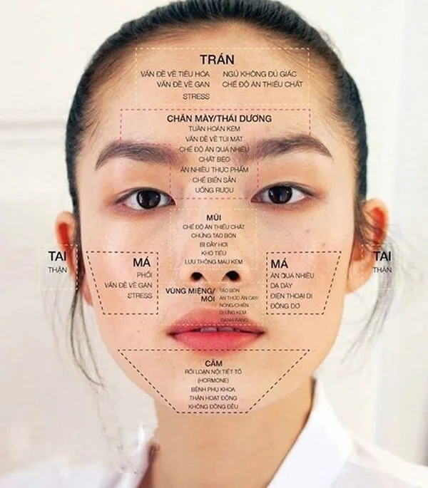 Vị trí mụn trên trán và cằm thường phản ánh các vấn đề sức khỏe nội tại của cơ thể
