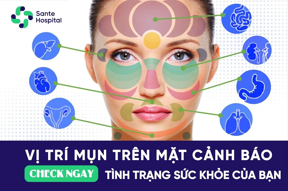 Bản đồ các vị trí mụn trên khuôn mặt phản ánh tình trạng sức khỏe của các cơ quan nội tạng