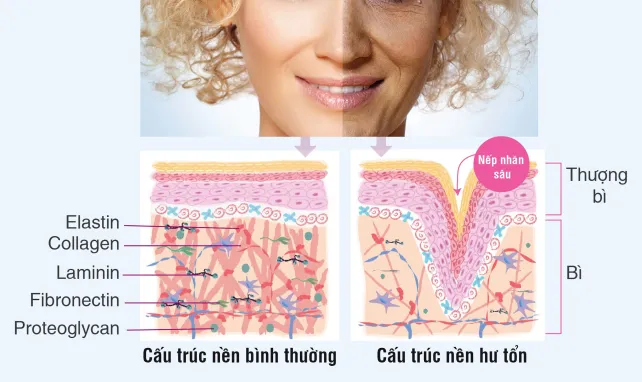 Tia cực tím là nguyên nhân hàng đầu phá hủy cấu trúc da cổ gây nhăn nheo
